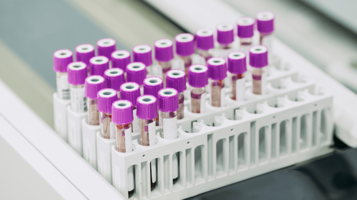 How to Use RFID to Improve the Efficiency of Lab Sample Tracking How to Use RFID to Improve the Efficiency of Lab Sample Tracking